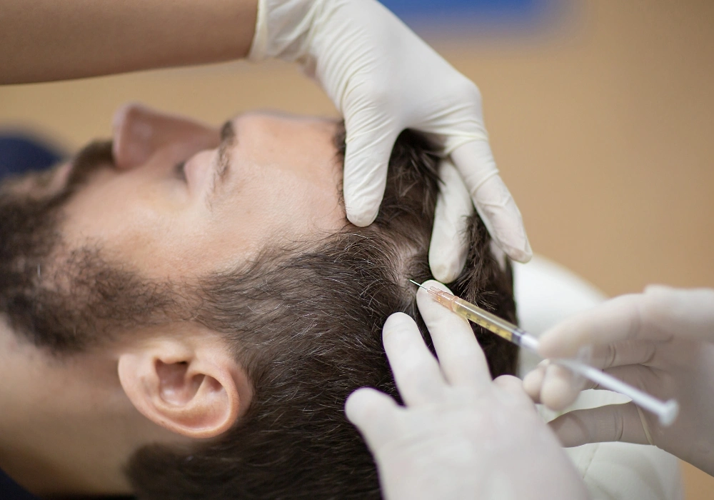 mesoterapia tratamiento capilar clinca teran mesoterapia tratamiento capilar clinca teran